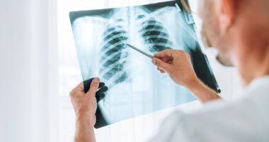 Silent threat that could crack the mystery of lung cancers in non-smokers