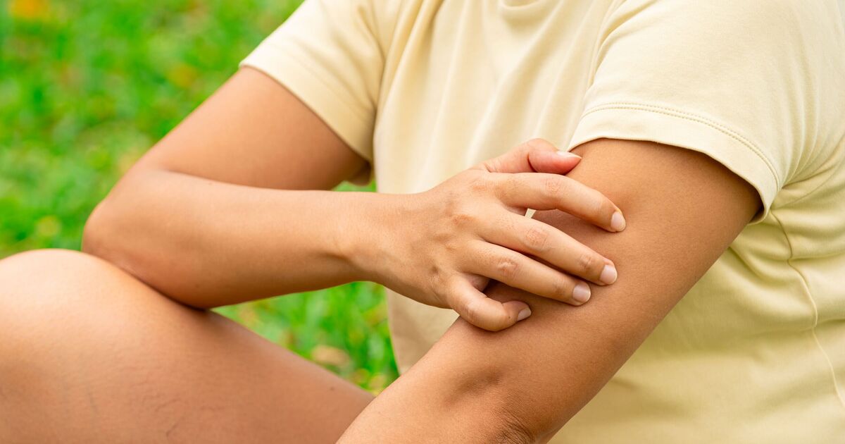 GPs urge people not to ignore 'stigmatised' itchy rash as cases soar