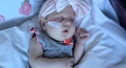 My womb tore during childbirth due to rare drug complication and my baby was left severely brain damaged