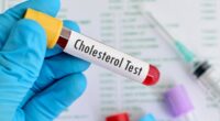 A 5-minute cholesterol check could spot if dementia will strike in 6 years time, experts find