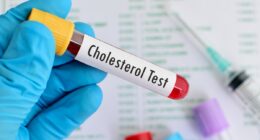 A 5-minute cholesterol check could spot if dementia will strike in 6 years time, experts find