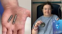 Game-changing dual pacemaker 'a major leap forward' in heart care