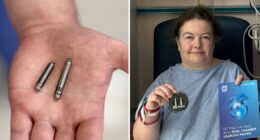 Game-changing dual pacemaker 'a major leap forward' in heart care