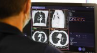 Global cancer explosion: Experts discover nations where you're most likely to die of the disease - it doesn't look good for the UK