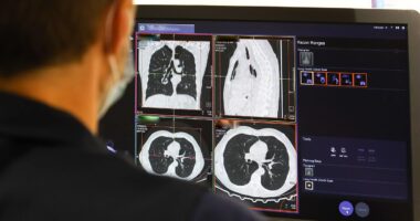 Global cancer explosion: Experts discover nations where you're most likely to die of the disease - it doesn't look good for the UK