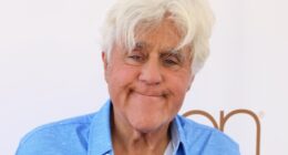 Medical Expert Debunks Viral Rumors About Jay Leno's Black Eye For Us