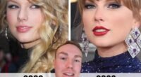 Can YOU guess the subtle plastic surgery that Taylor Swift's rumoured to have had done? Leading cosmetic expert hints at megastar's nip tuck