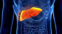 Six early warning signs of silent killer liver disease that might go unnoticed