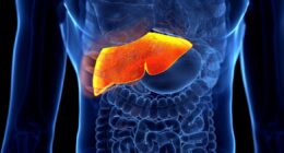 Six early warning signs of silent killer liver disease that might go unnoticed