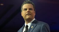 What Happened To Matt Gaetz? Cosmetic Expert Breaks Down His Shocking Transformation