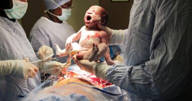 Why caesarean babies may soon be getting this very unappetising 'shake'