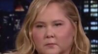 Amy Schumer reveals trolling over her ‘moon face’ led to Cushing Syndrome diagnosis