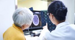 Dementia study sheds light on how long people can expect to live after diagnosis