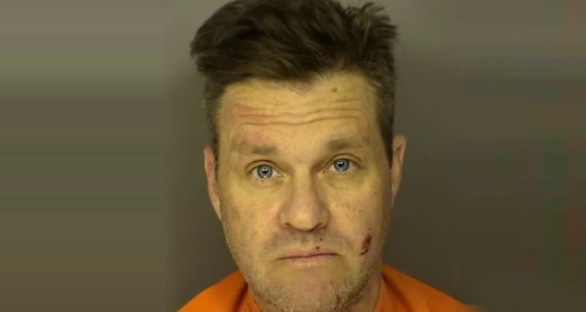 Home Improvement’s Zachery Ty Bryan seen bruised & cut up in mug shot as he’s arrested again months after felony charge