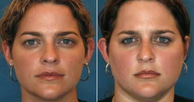 Study of dozens of identical twins reveals shocking effect bad diet and divorce has on your face