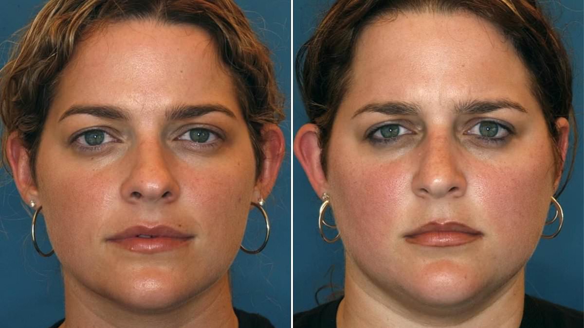 Study of dozens of identical twins reveals shocking effect bad diet and divorce has on your face