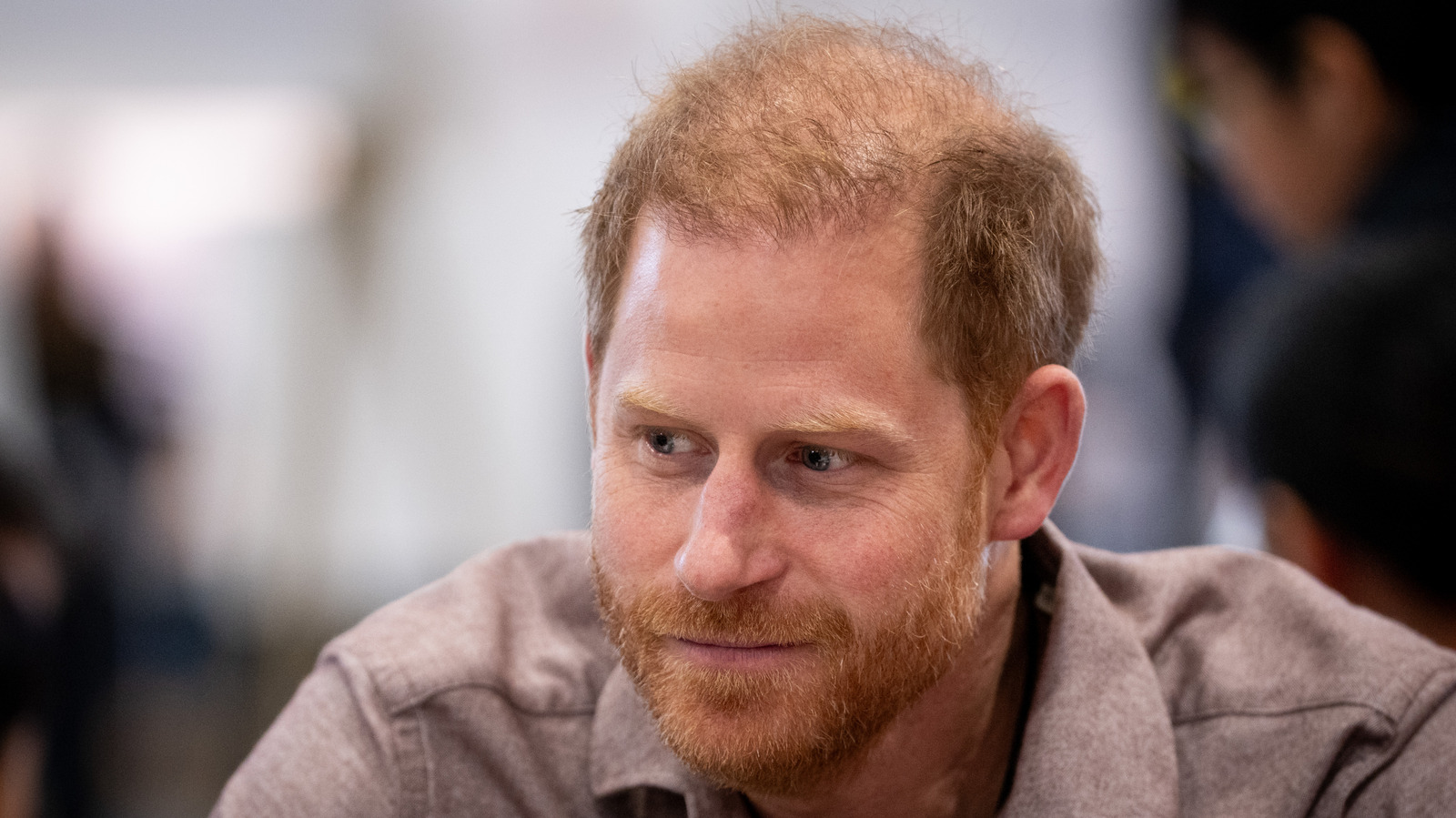 The Rampant Prince Harry Hair Transplant Rumors, Explained