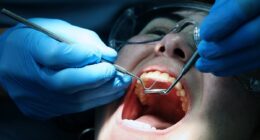 Brits who need urgent dental treatment could be forced to rely on 'Victoria-era' solutions, medical leaders warn - as 2.2m people waiting for care