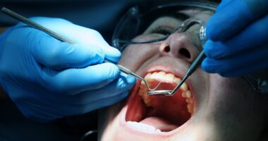 Brits who need urgent dental treatment could be forced to rely on 'Victoria-era' solutions, medical leaders warn - as 2.2m people waiting for care