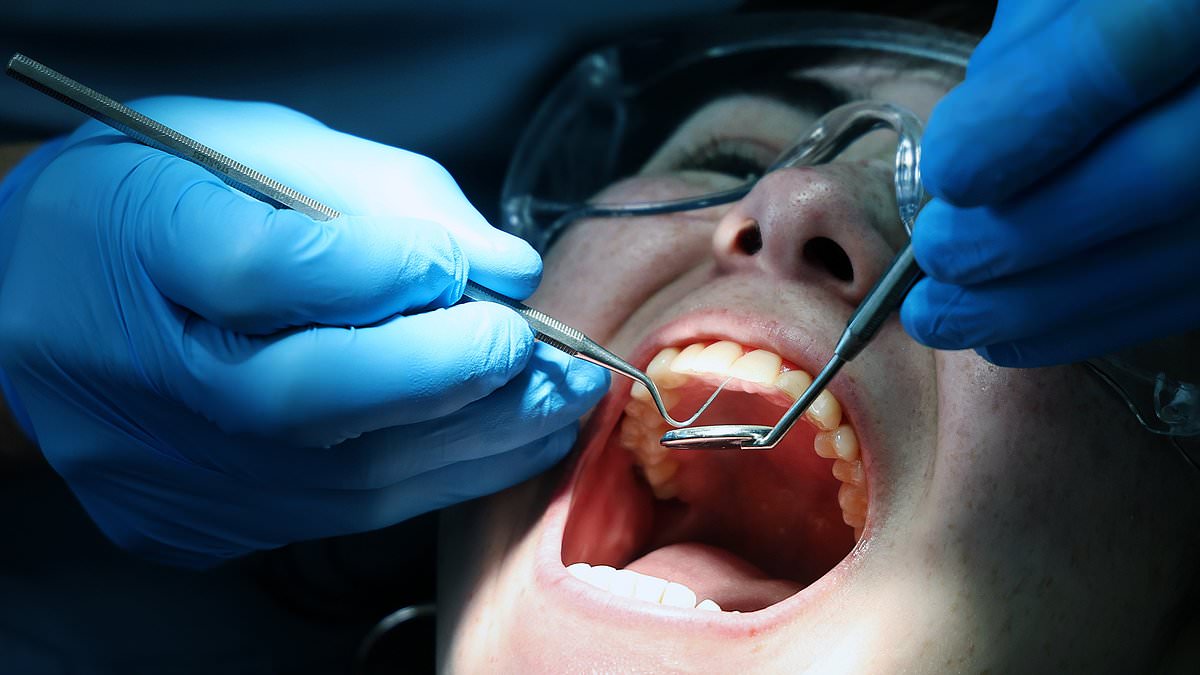 Brits who need urgent dental treatment could be forced to rely on 'Victoria-era' solutions, medical leaders warn - as 2.2m people waiting for care