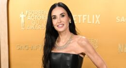 Celebs' skinny appearance at SAG Awards sparks alarm over rise of 'Ozempic arms' - expert warns stars abusing jabs may be left PEMANENTLY emaciated