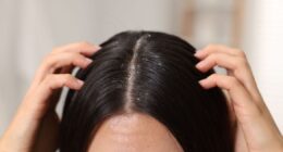 Cheap kitchen staple ‘works wonders’ to banish build-up on scalp and make hair luscious