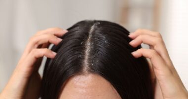 Cheap kitchen staple ‘works wonders’ to banish build-up on scalp and make hair luscious