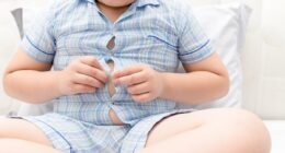 Obese children more than twice as likely to get MS when they get older, study claims