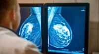 Record number of women are getting mammograms, but a third are still ignoring the crucial checkups