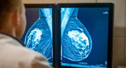 Record number of women are getting mammograms, but a third are still ignoring the crucial checkups