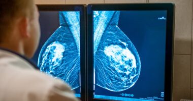 Record number of women are getting mammograms, but a third are still ignoring the crucial checkups