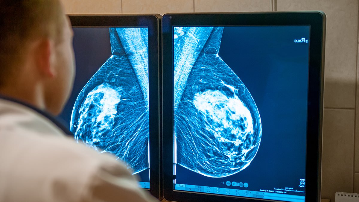 Record number of women are getting mammograms, but a third are still ignoring the crucial checkups