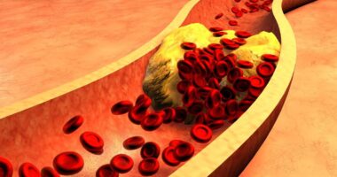 Seven-day cholesterol-lowering meal plan by cardiac experts may reduce statin dependency