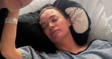 Teddi Mellencamp’s brain surgery recovery ‘could be a years-long fight’ but RHOBH star is ‘determined’ and ‘optimistic’