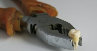 Dental MAYHEM: A quarter of Brits who can't get a dentist appointment resort to 'using pliers' or 'Turkey teeth', shock report finds